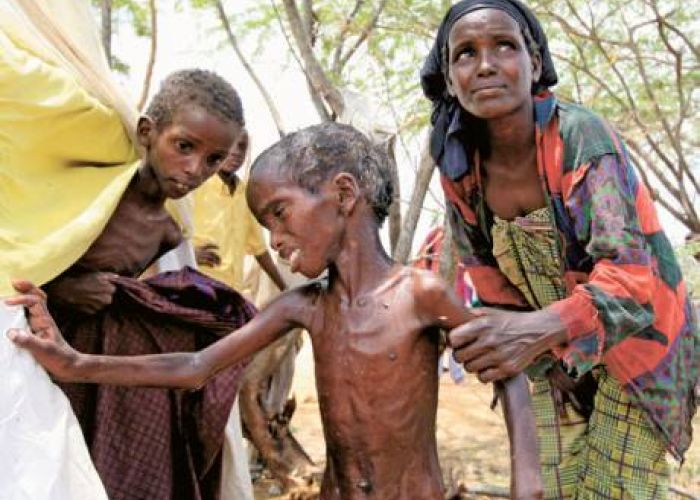 Yémen/Arabie Saoudite : la famine utilisée comme arme de guerre