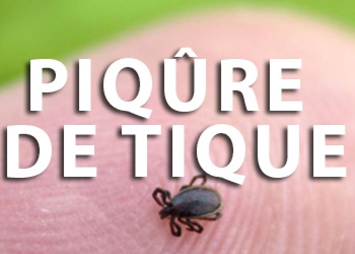 Piqûre de tique, maladie de Lyme : On vous dit tout !