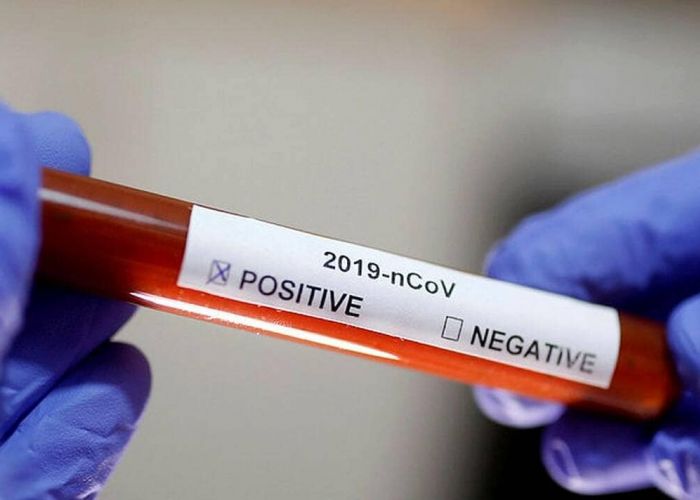 Coronavirus: 556 nouveaux cas positifs, 13 morts supplémentaires et 451 guéris