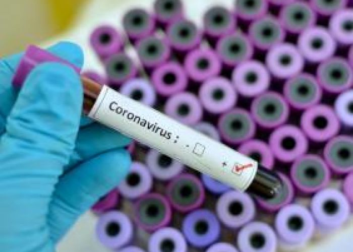 Coronavirus en Algérie (nouveau bilan) : 495 cas,11 décès et 364 guéris