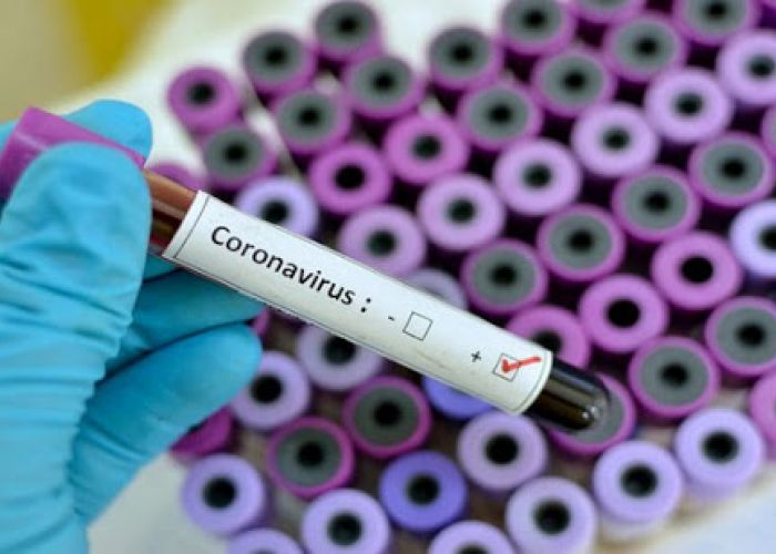 Coronavirus: 99 nouveaux cas contrôlés positifs et 10 décès supplémentaires 