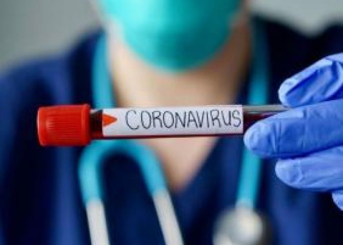 Coronavirus en Algérie (nouveau bilan) : 209 cas, 138 guérisons et 07 décès ces dernières 24h 