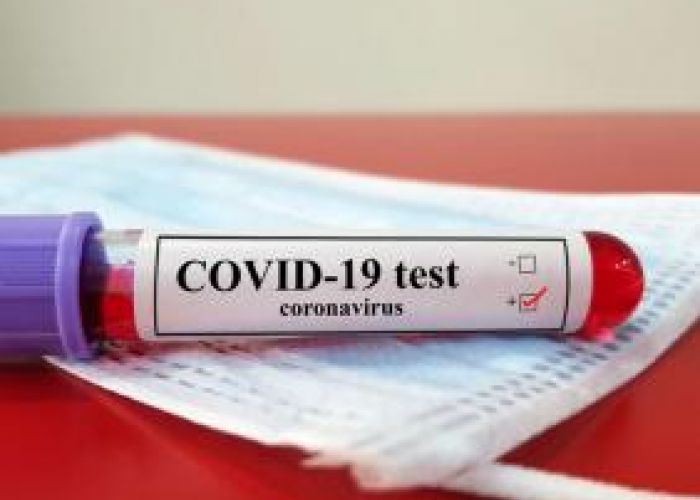 Coronavirus : légère baisse des contaminations, à 203 nouveaux cas, au bilan des dernières 24h