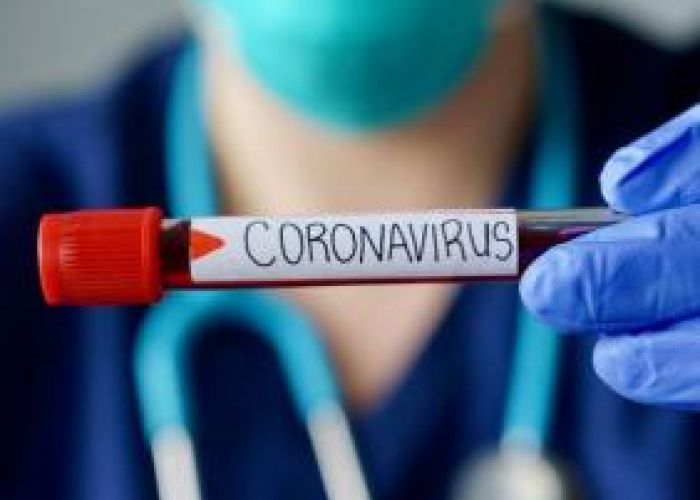 Coronavirus en Algérie (nouveau bilan) : 164 cas, 143 guérisons et 4 décès ces dernières 24h 