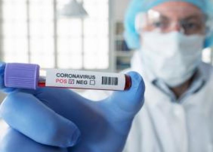 Coronavirus en Algérie (nouveau bilan) : 210 cas, 188 guérisons et 03 décès