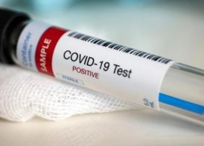 Coronavirus en Algérie (nouveau bilan) : 227 cas, 190 guérisons et 02 décès ces dernières 24h