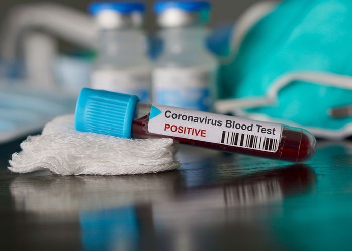  Lutte contre le Coronavirus : la solidarité nationale au rendez-vous