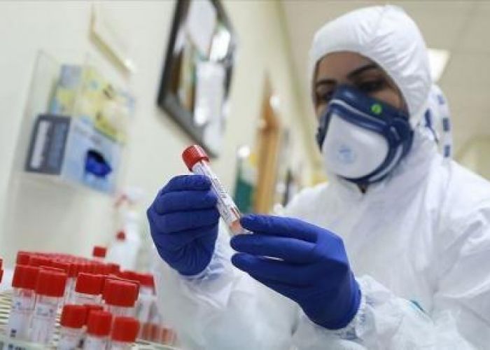 Coronavirus en Algérie (nouveau bilan) : 132 cas, 122 guérisons et 04 décès ces dernières 24h