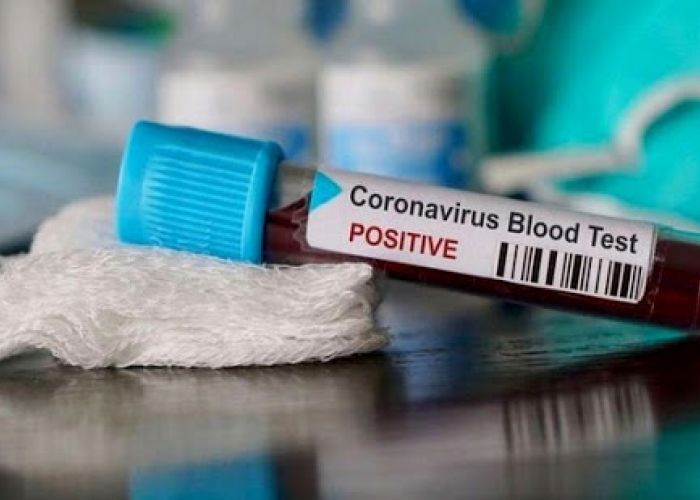 Coronavirus: 198 nouveaux cas positifs, 04 morts et 183 guérisons