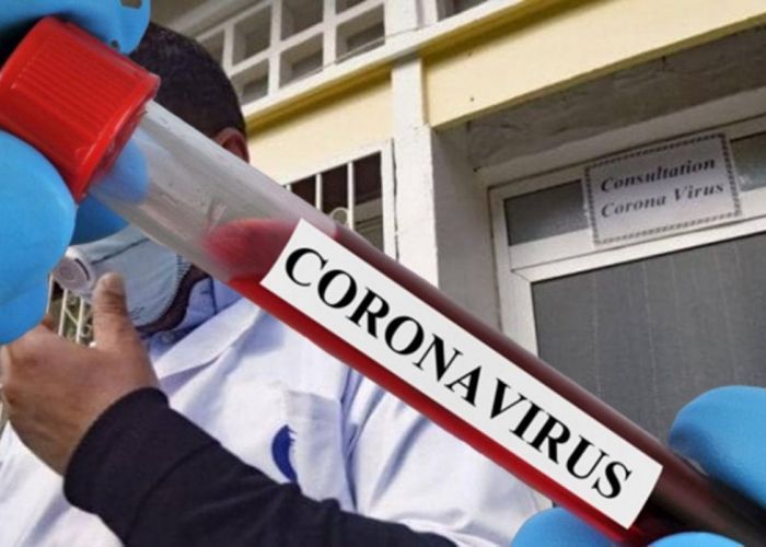 Coronavirus: 130 nouveaux cas confirmés, 03 morts et 118 guérisons 