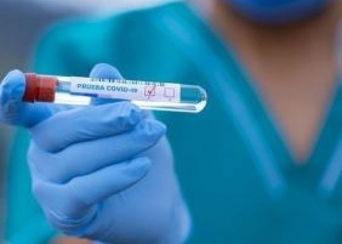 Coronavirus en Algérie (nouveau bilan) : 264 cas, 10 décès, 161 guérisons et 32 patients en soins intensifs