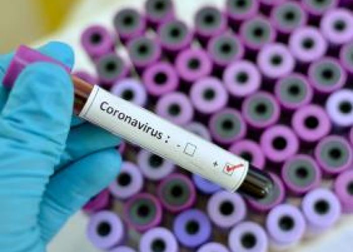 Coronavirus en Algérie (nouveau bilan) : 434 cas, 08 décès, 487 guéris et 50 patients en réanimation 