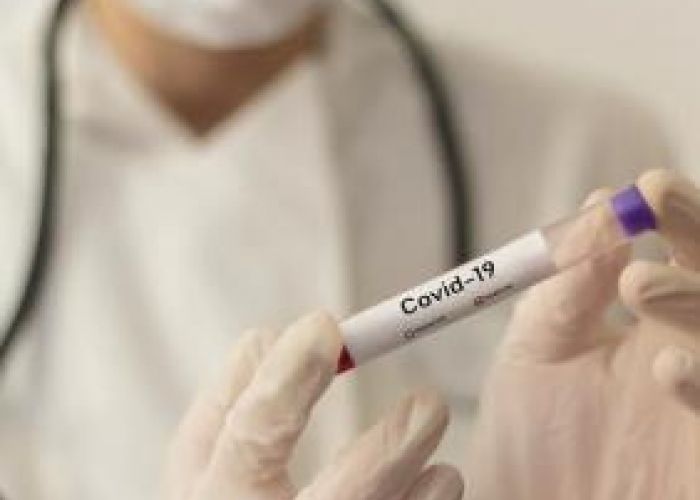 Coronavirus : la courbe continue de monter avec 475 nouveaux cas enregistrés ces dernières 24 heures