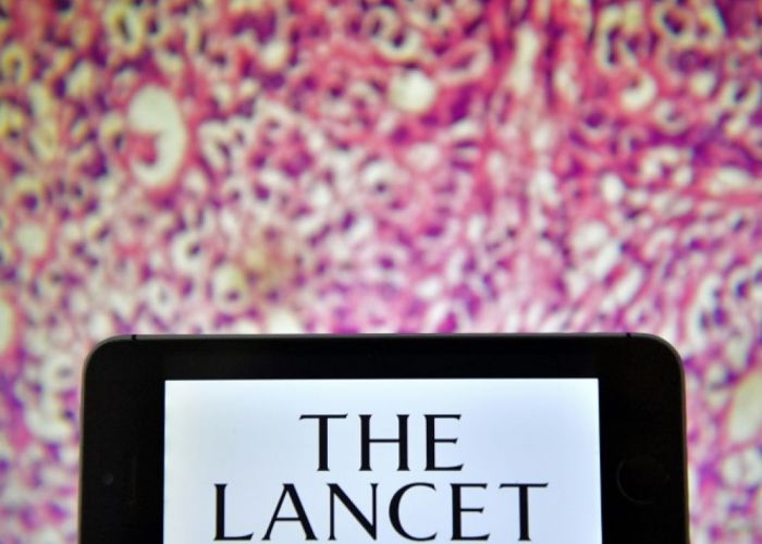 Hydroxychloroquine : trois des auteurs de l'étude se rétractent, "The Lancet" retire l'article