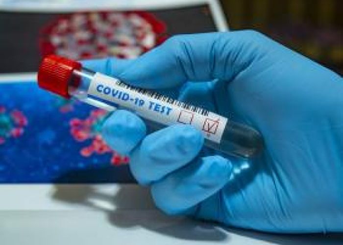 Coronavirus en Algérie (nouveau bilan) : 179 cas confirmés, 4 décès et 64 guéris