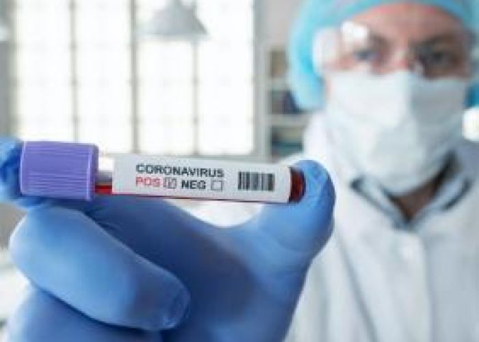 Coronavirus en Algérie (nouveau bilan) : 190 cas confirmés, 7 décès et 194 nouvelles guérisons