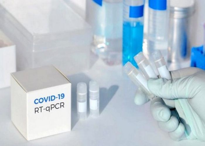 Covid-19 : L'Algérie produira jusqu'à 200.000 kits de dépistage rapide par semaine