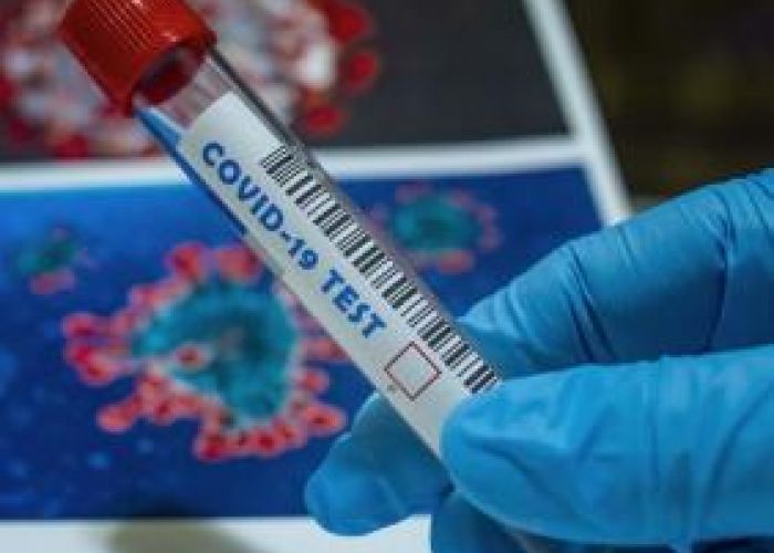 Coronavirus en Algérie (nouveau bilan) : 336 nouveaux cas, 236 guérisons et 07 décès ces dernières 24h