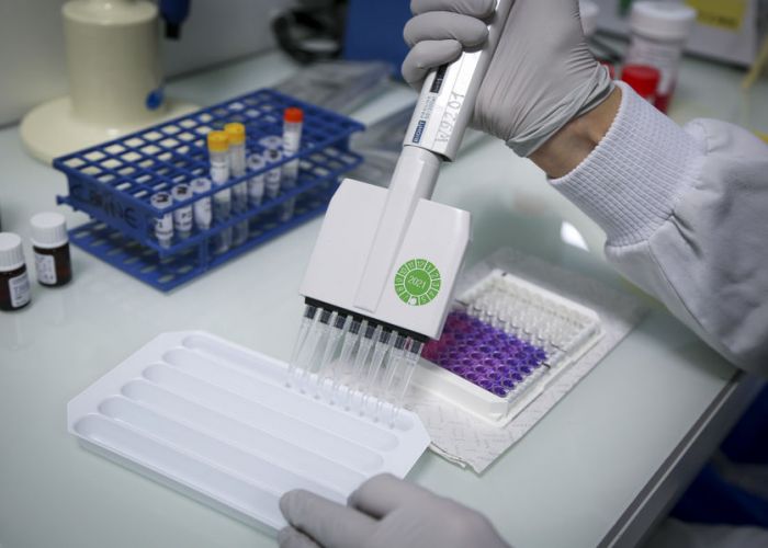 Tests PCR et scanner: des laboratoires privés annoncent de substantielles baisses des tarifs