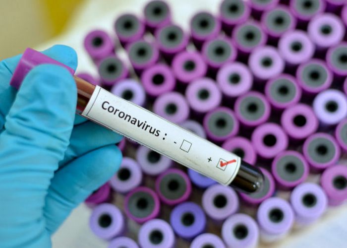 Coronavirus en Algérie : Le bilan est de 367 cas confirmés, 25 décès et 29 personnes guéries pour la journée de jeudi