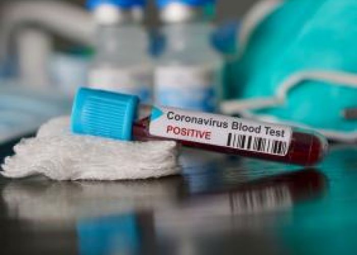 Coronavirus en Algérie (nouveau bilan) : 185 cas, 9 décès et 111 guéris