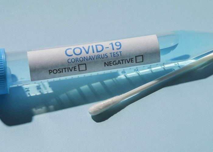 Lutte contre le Covid-19 : Production de tests antigéniques et PCR dans trois laboratoires nationaux