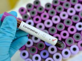 Coronavirus en Algérie (nouveau bilan) : 412 cas, 395 guérisons et 20 décès ces dernières 24h