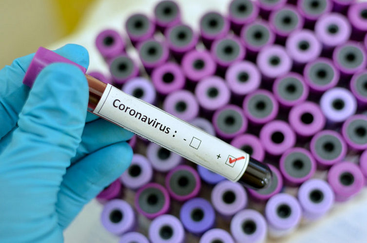 Coronavirus : la Covid-19 enfourche, à nouveau, une courbe ascendante; la hantise toujours là.