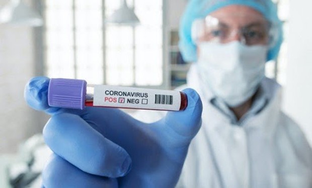 Coronavirus: léger rebond du nombre de décès (41) et baisse des cas positifs (1307)