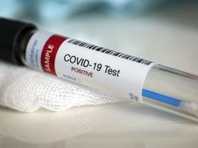 Coronavirus en Algérie (nouveau bilan) : 1203 cas, 736 guérisons et 46 décès ces dernières 24 heures