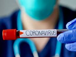 Coronavirus en Algérie (nouveau bilan) : 81 cas, 69 guérisons et 4 décès ces dernières 24 heures