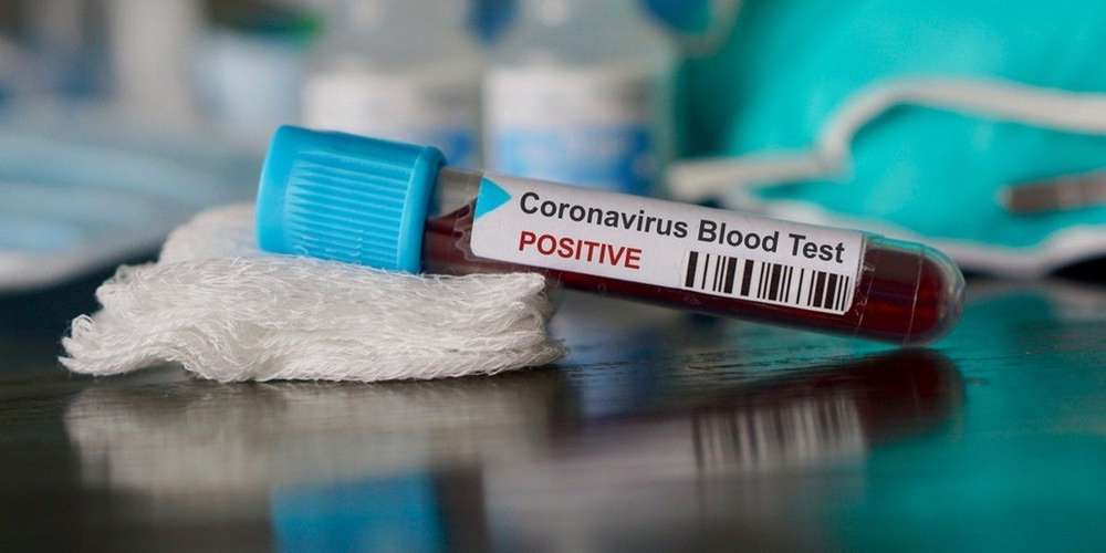 Coronavirus en Algérie : 218 nouveaux cas, 166 guérisons et 5 décès ces dernières 24h