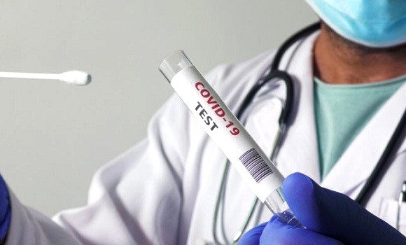 Coronavirus en Algérie : 161 nouveaux cas, 126 guérisons et 6 décès ces dernières 24 heures